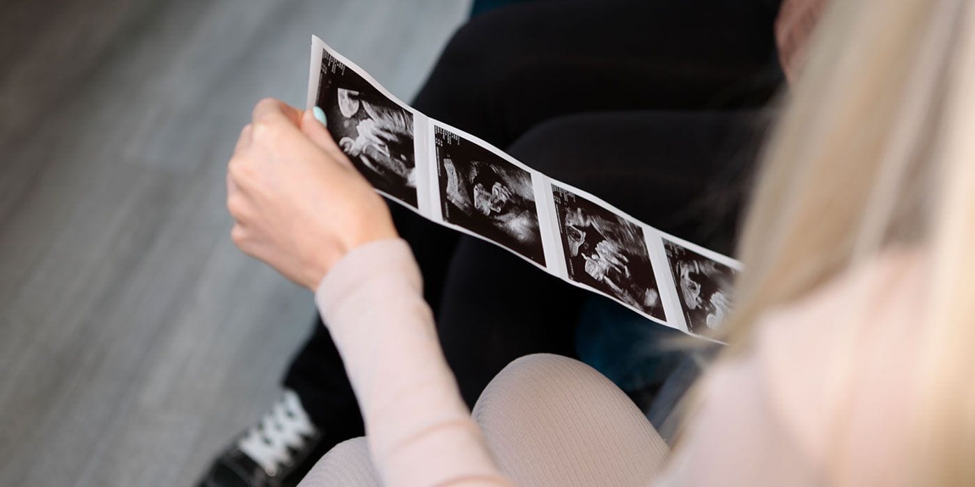 Expectant mother holding a strip of printed ultrasound scan photos