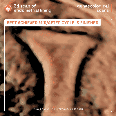 3D ultrasound image of the endometrial lining from a gynaecological pelvic scan