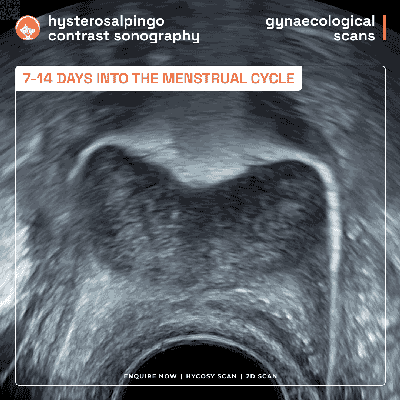 Consultant gynaecologist performing a HyCoSy scan at London Pregnancy Clinic