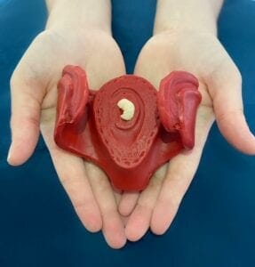 Life-size model of a womb held in two hands, showing an embryo at 8 weeks of pregnancy