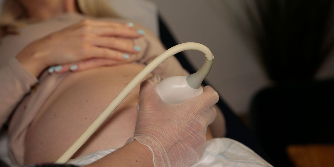 Gloved hand holding an ultrasound probe on a pregnant woman's bump during a scan