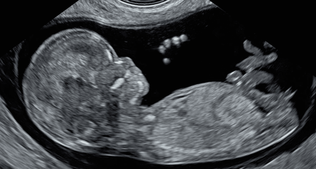 Cardiac scan