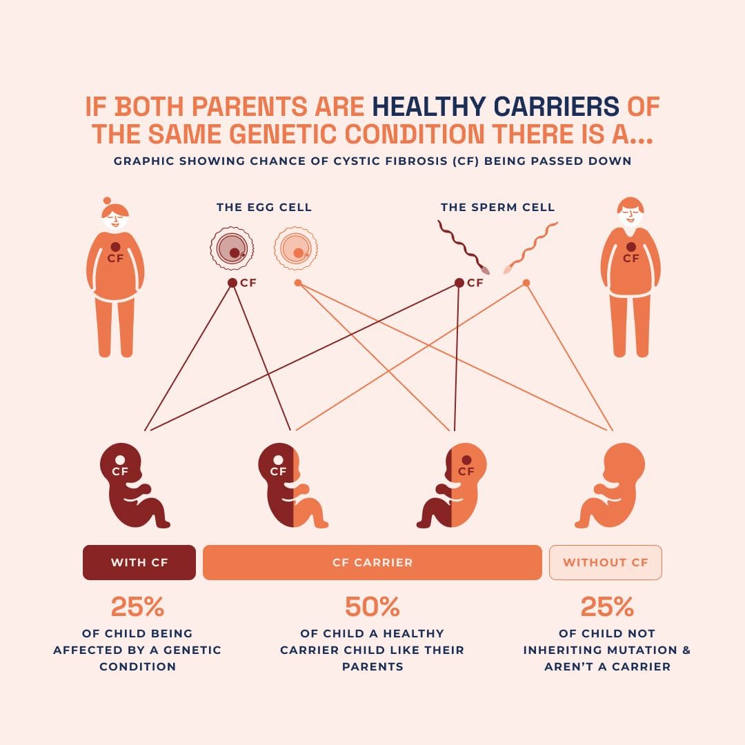 Carrier screening diagram, by London Pregnancy Clinic, showing the chances of passing on cystic fibrosis if both parents are healthy carriers, with 25% chance of child having CF, 50% chance of child being a carrier, and 25% chance of child not inheriting CF.