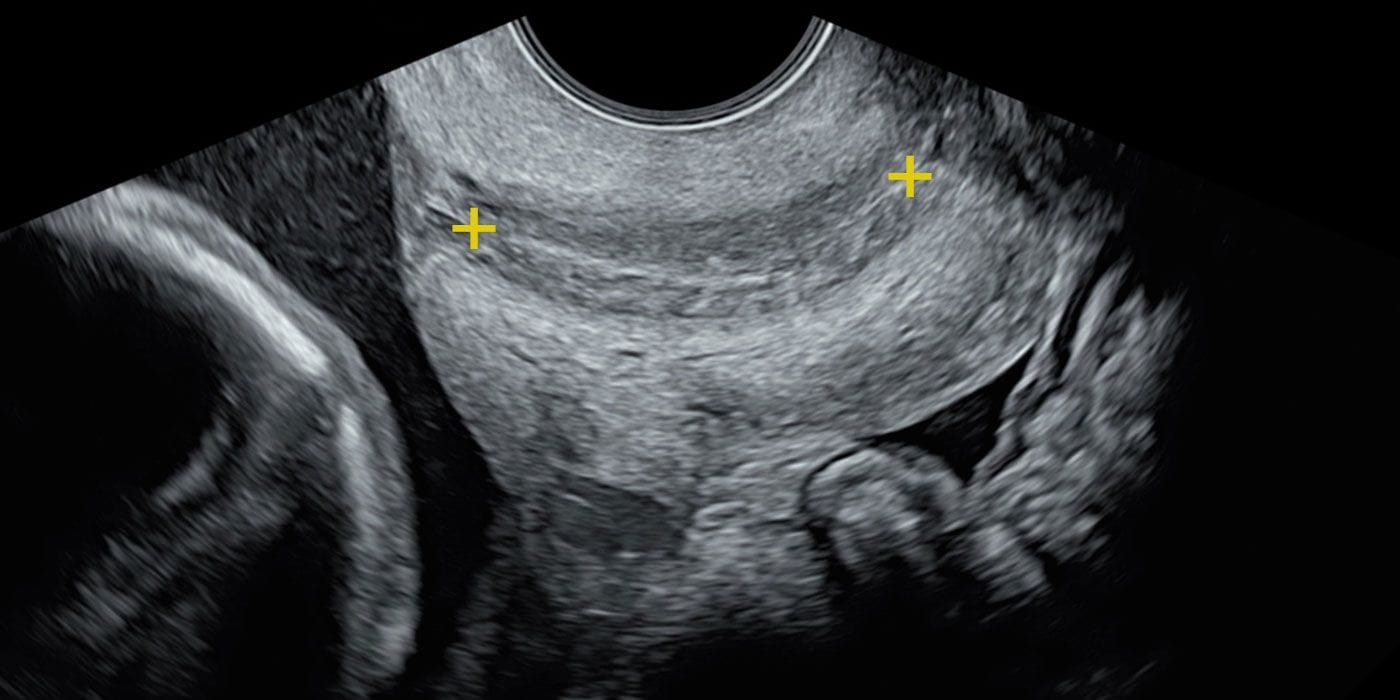 Cervical scan
