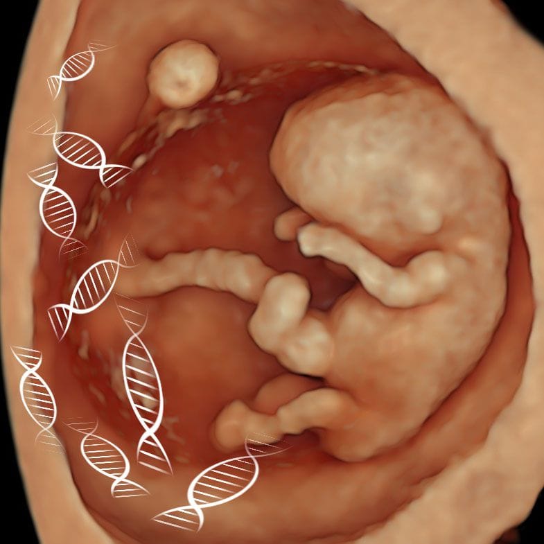 3D ultrasound of a fetus at 12 weeks captured on our Early Fetal Scan