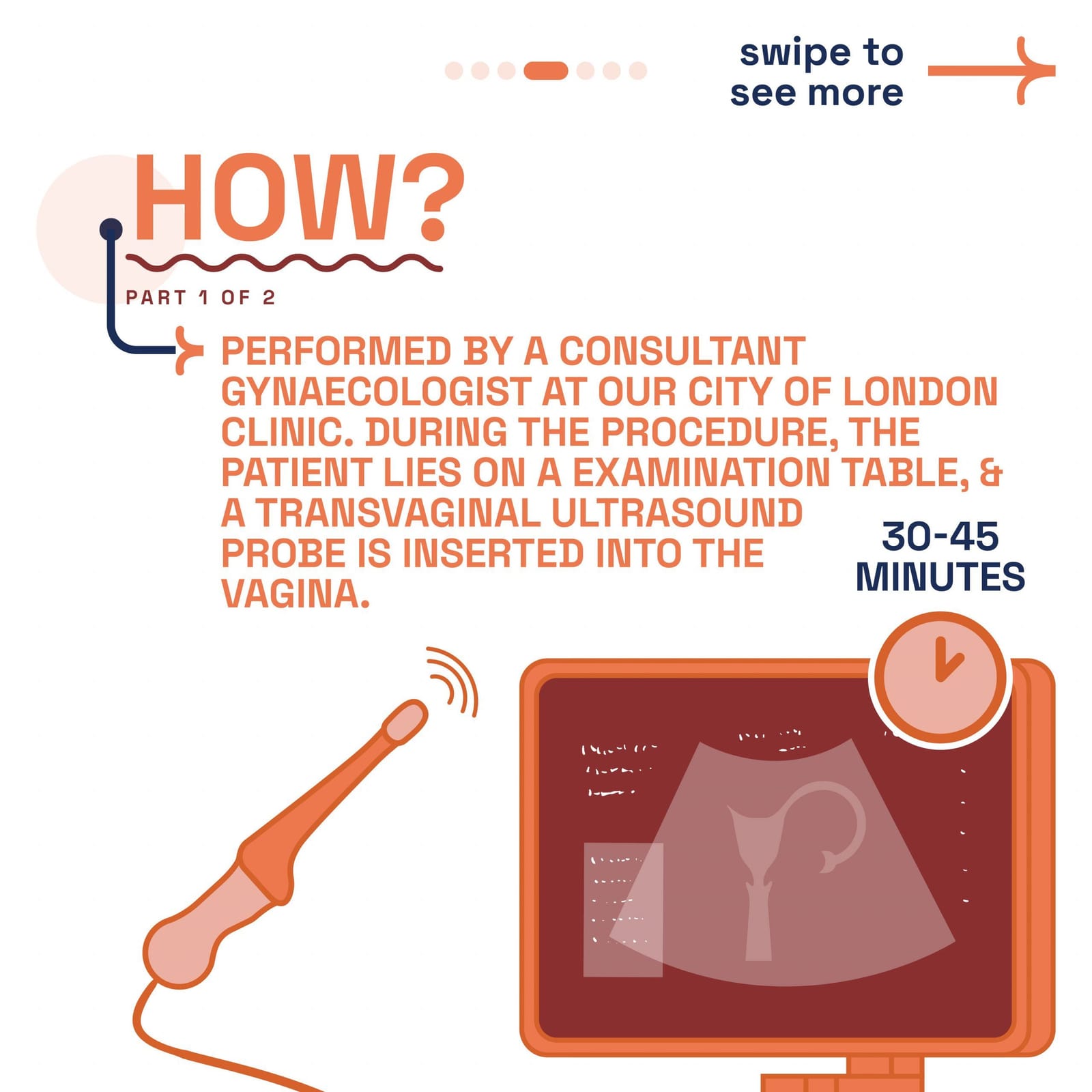 HyCoSy procedure — step 4