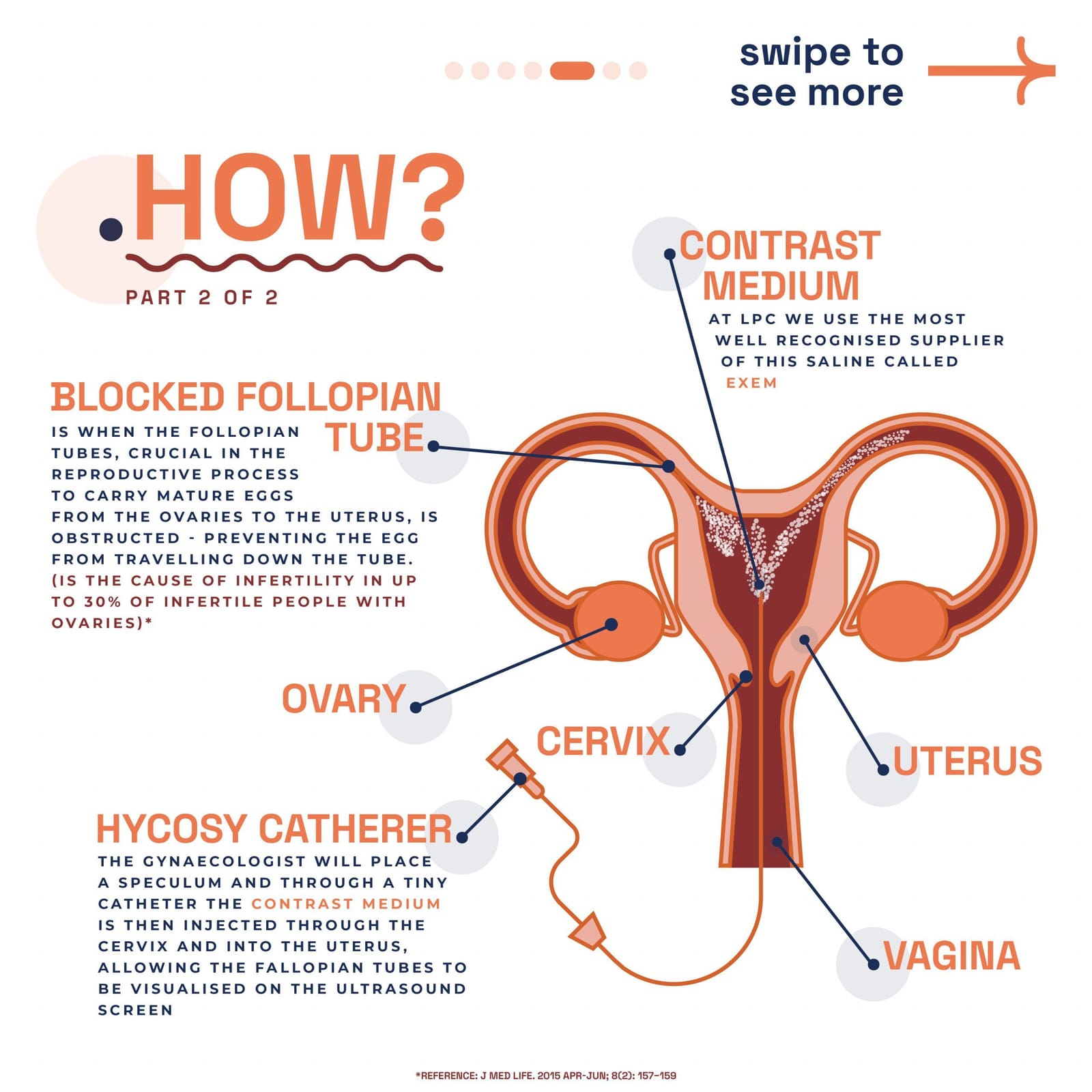 HyCoSy procedure — step 5