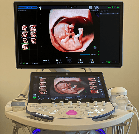 SMART test at 10 weeks by Voluson Expert 22
