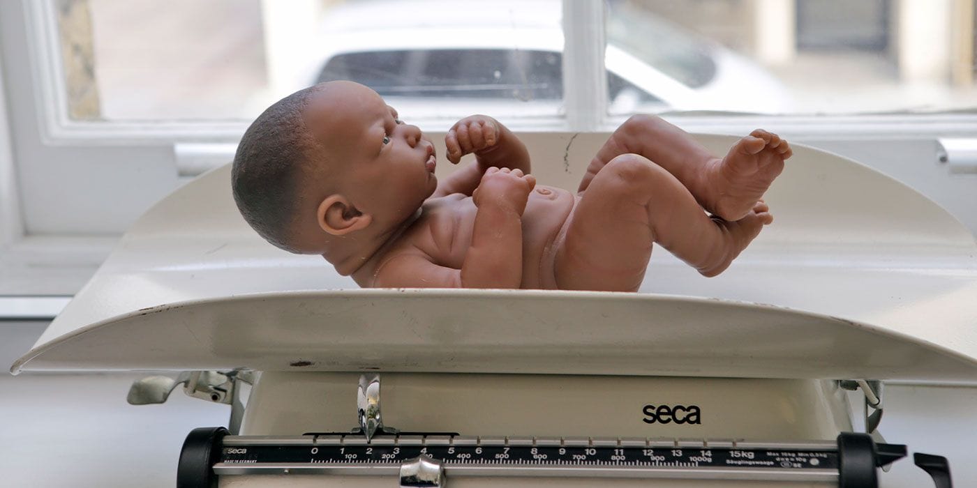 Presentation Scan - Checking the position of your baby to exclude breech presentation