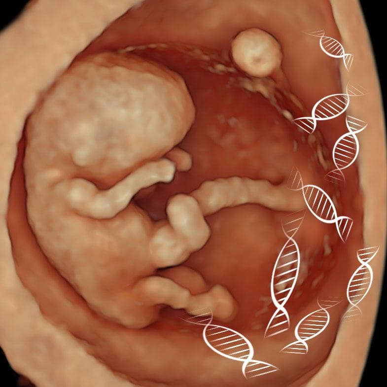 Non-invasive prenatal screening for rare diseases