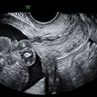 Cervical Scan