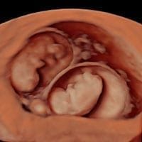 Transvaginal Scan