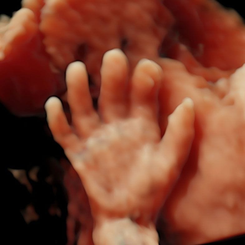 3rd Trimester Ultrasound Scan 4d scan of a hand done at London Pregnancy Clinic.