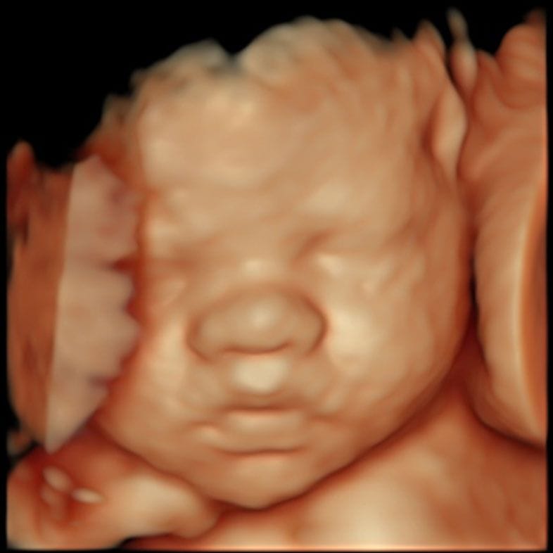 Third-trimester ultrasound image of a baby's abdomen during a growth assessment