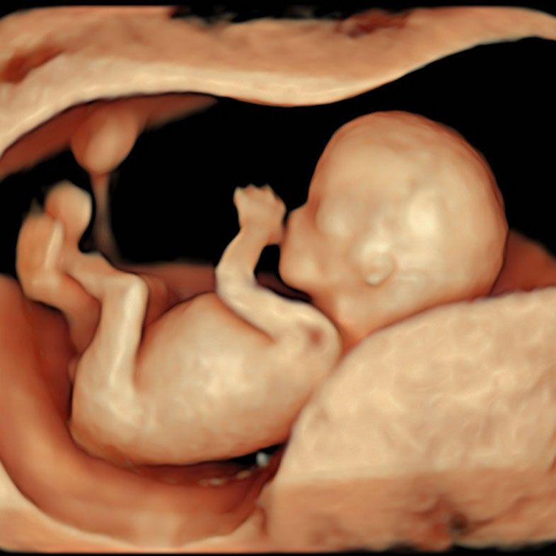 3D ultrasound of a fetus at 12 weeks captured on our Early Fetal Scan. This is one of the Early Pregnancy Scans we offer in London.