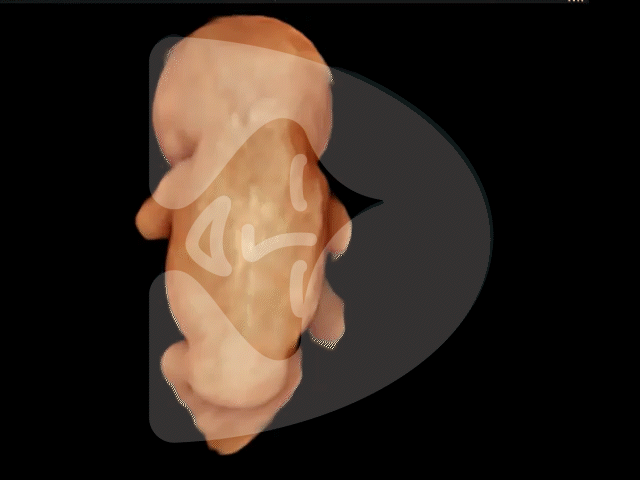 3D Ultrasound GIF of baby at 10 week. Image by London Pregnancy Clinic - for educational purpose.