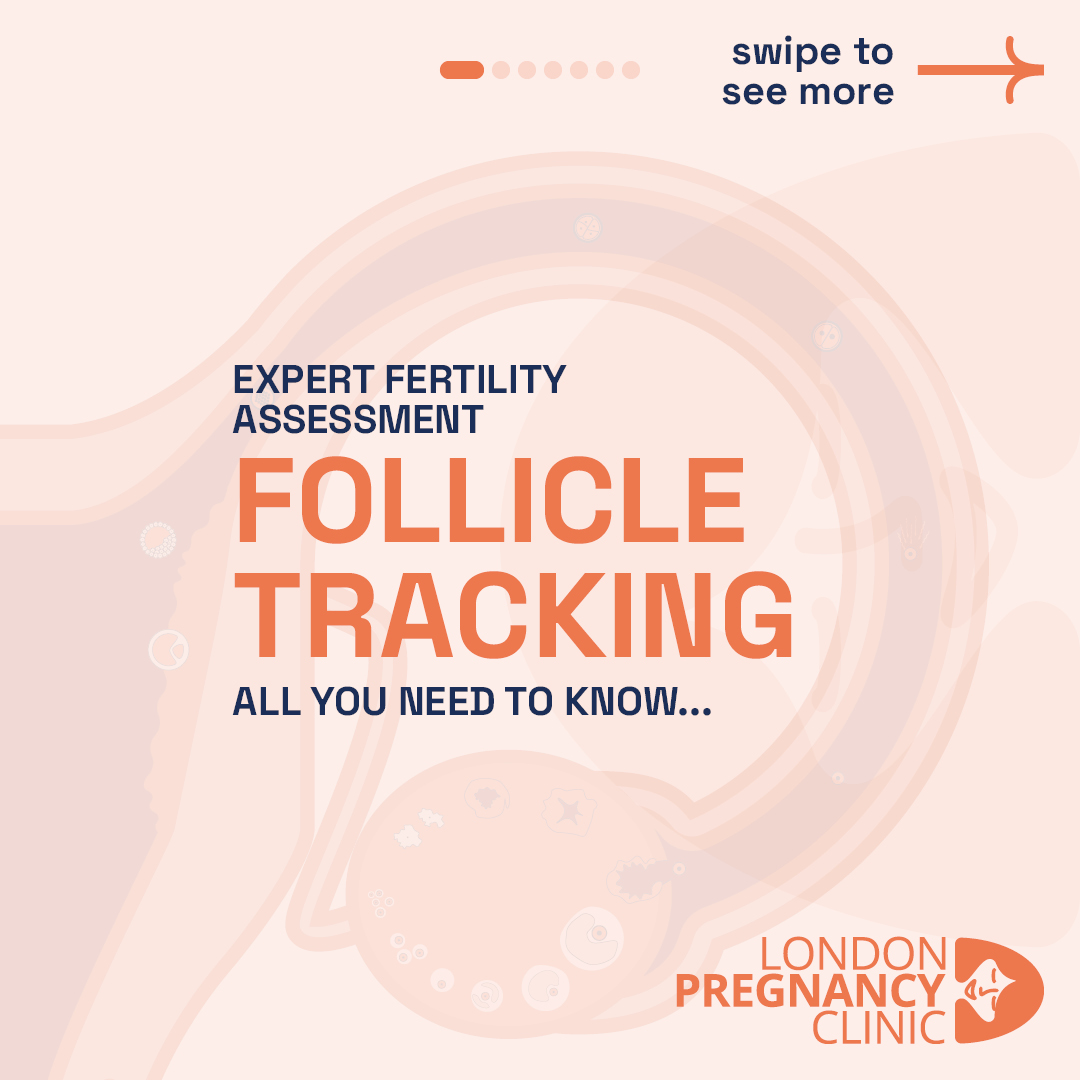 Graphic by London Pregnancy Clinic featuring the text 'Expert Fertility Assessment' and 'Follicle Tracking - All you need to know...' against a soft, abstract background representing fertility.