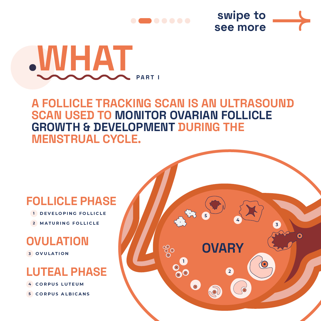 Informative illustration by London Pregnancy Clinic explaining follicle tracking scans with labeled diagram of the ovary showcasing different stages from the follicle phase to the luteal phase.