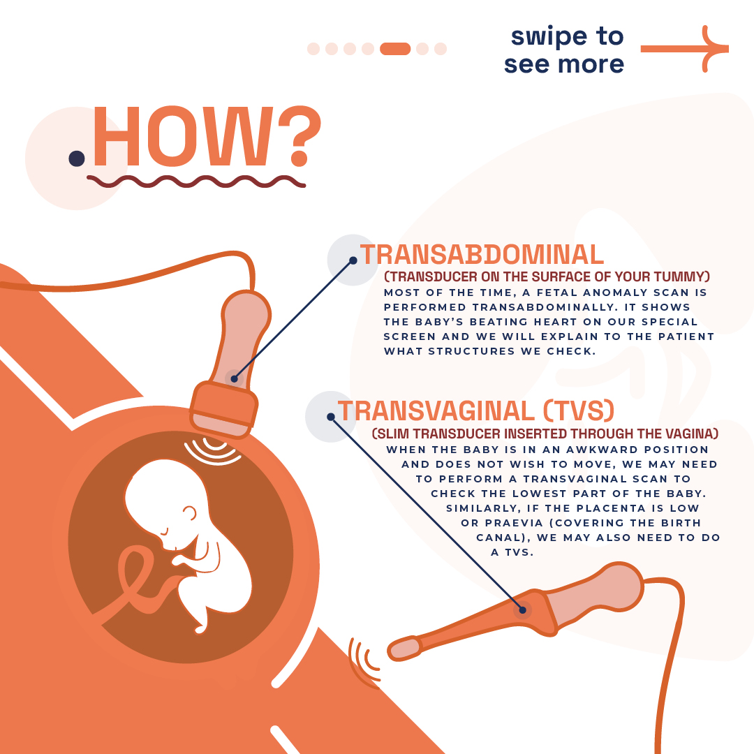 Illustration explaining transabdominal and transvaginal ultrasound scans at London Pregnancy Clinic.